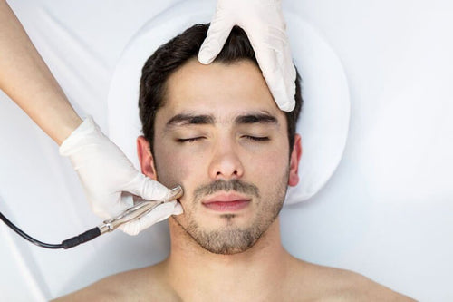 Men's Microdermabrasion - 3 Treatment Package